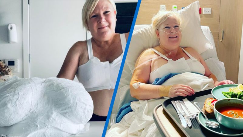 Jay-Jay shares stunning results after her breast reduction surgery 
