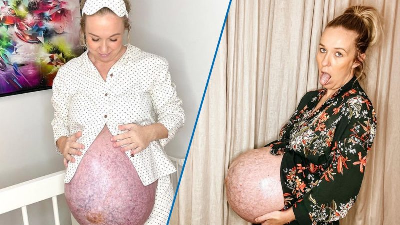 Mum's 'unique' baby bump at 35 weeks leaves people speechless